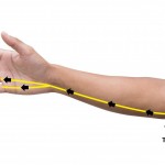 VẬT LÝ TRỊ LIỆU HỘI CHỨNG CHÈN ÉP THẦN KINH TRỤ