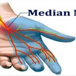 VẬT LÝ TRỊ LIỆU PHỤC HỒI CHỨC NĂNG TỔN THƯƠNG THẦN KINH GIỮA
